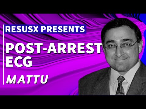 Видео: На что обратить внимание на ЭКГ после ACLS