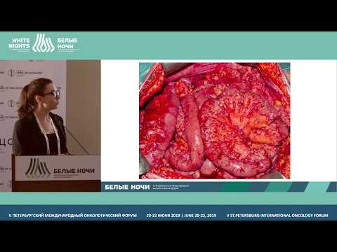 Видео: Карциноматоз: патоморфология для рентгенолога (Хохлова А.В.)