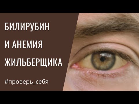 Видео: Высокий БИЛИРУБИН. Почему и как СНИЗИТЬ?