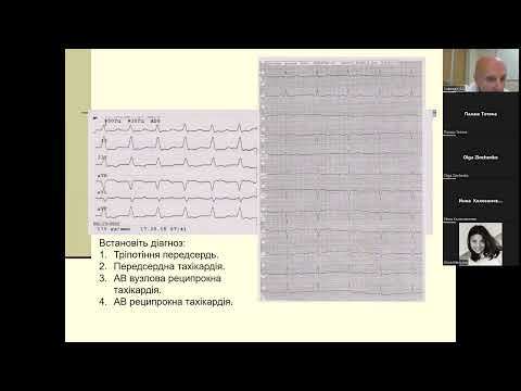 Видео: Cуправентрикулярні тахікардії (частина 3)
