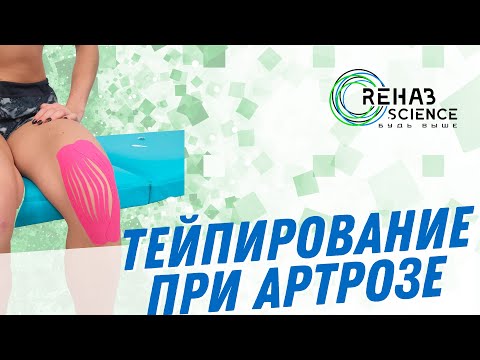 Видео: Кинезиотейпирование при артрозе. Тейпирование коленного сустава.