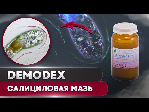 Видео: Салициловая мазь 2% против клеща | Угревая Железница Demodex
