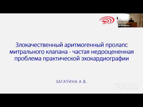 Видео: Злокачественный аритмогенный пролапс митрального клапана – частая недооцененная проблема ЭхоКГ