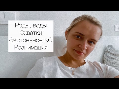 Видео: РОДЫ . ВОДЫ . СХВАТКИ. Экстренное КС . РЕАНИМАЦИЯ