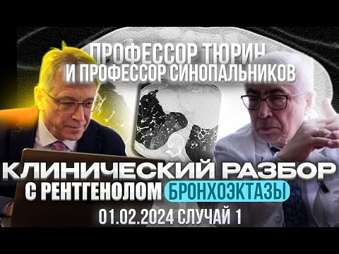 Видео: Клинический разбор с рентгенологом. Профессор Тюрин. Бронхоэктазы. Разбор 01.02.2024 случай 1.
