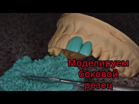 Видео: Моделировка зубов. Как моделировать боковой резец? Серия видео моделировки верхних зубов.