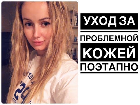 Видео: Последний День 5. Жирная Себорея, жирная кожа=прыщи