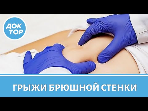 Видео: Лечение грыж передней брюшной стенки