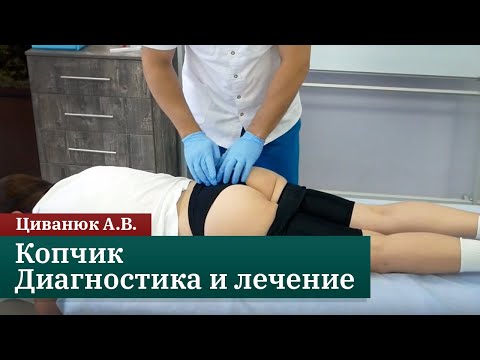 Видео: Копчик. Диагностика и лечение. Циванюк А.В.