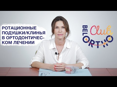 Видео: Ротационные подушки/ротационные клинья в ортодонтическом лечении | БелОртоКлуб