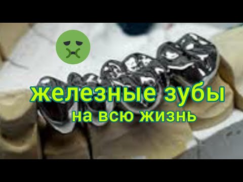 Видео: МЕТАЛЛИЧЕСКИЕ зубные коронки. КОРОНКА металлическая цельнолитая.