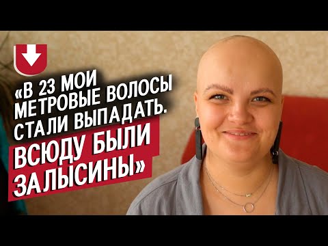 Видео: Я облысела в 30 лет: Алена | Быть молодым