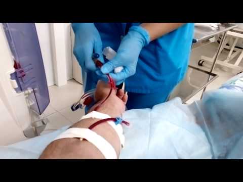 Видео: ДИАЛИЗ без прикрас