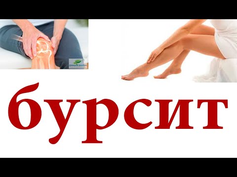 Видео: Бурсит.Как лечить в домашних условиях#малиноввский
