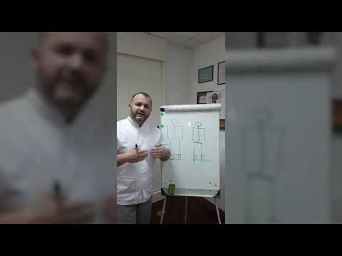 Видео: Плоскостопие и сколиоз. Боровской Евгений — врач ортопед-травматолог