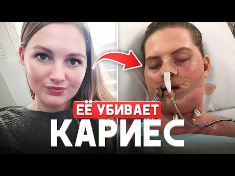 Видео: Смертельный КАРИЕС. Реальные Истории и Последствия