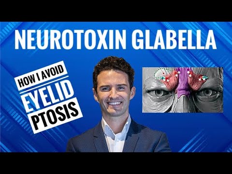 Видео: Руководство по инъекциям: Нейротоксин и Глабелла