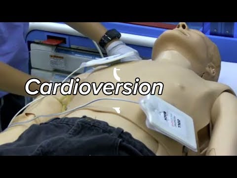Видео: Кардиоверсия | Методика дефибрилляции