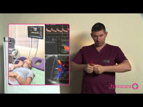 Видео: Головная боль. Мигрень. Внутричерепное давление