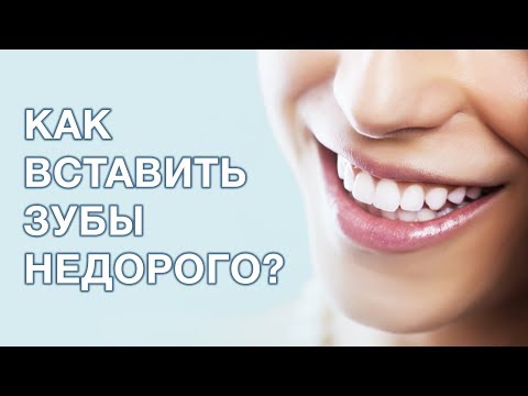 Видео: Как вставить зубы недорого? Что выбрать при ограниченном бюджете?