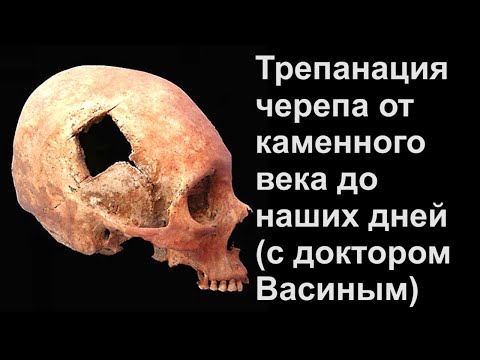 Видео: Трепанация черепа от каменного века до наших дней (с доктором Васиным)