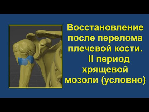 Видео: 2. Восстановление после перелома верхней трети плечевой кости. Период хрящевой мозоли (условно)