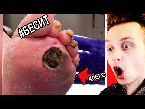 Видео: ВСЯ БОЛЬ В ОДНОМ ВИДЕО.. Попробуй не СКАЗАТЬ ФУ! РЕАКЦИЯ на САМОЕ НЕПРИЯТНОЕ ВИДЕО ТикТок Райли