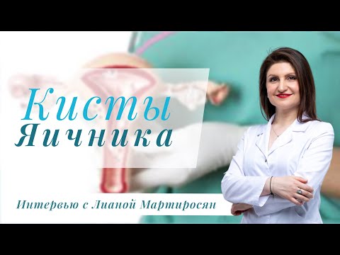 Видео: Киста яичника или рак. Лечить/оперировать? Лечебный подкаст с Лианой Мартиросян с Викторией Вроцкой.