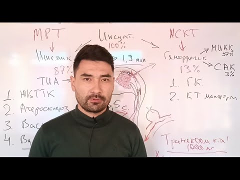 Видео: Инсулт касаллиги. Касаллик белгилари, диагностика ва даволаш. #insult #инсульт