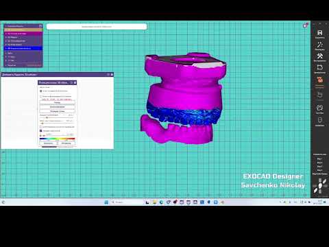 Видео: Перенос позиции с физического артикулятора в цифровой по доп. скану.