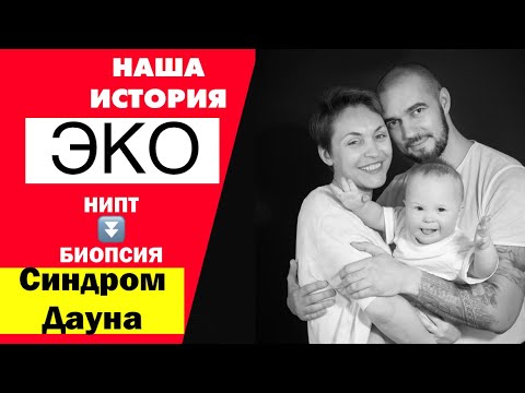 Видео: ПРО БЕРЕМЕННОСТЬ. ЭКО. ОШИБКА БИОПСИИ. РИСКИ ПО УЗИ СИНДРОМ ДАУНА. СКРИНИНГ, НИПТ, НИПС.