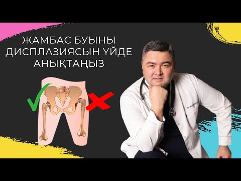 Видео: Жаңа туған баладағы Жамбас буын дисплазиясы, алғашқы белгілерін қалай бі