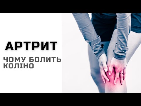 Видео: Артрит. Причини болі в колінному суглобі | ортопед-травматолог Віктор Костюк | Ранок надії