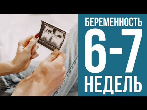 Видео: 6-7 недель беременности: что происходит с малышом и как чувствует себя мама?