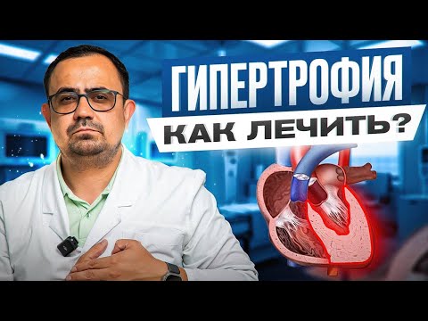 Видео: Чем ОПАСНА гипертрофия левого желудочка? Признаки, лечение, прогноз жизни