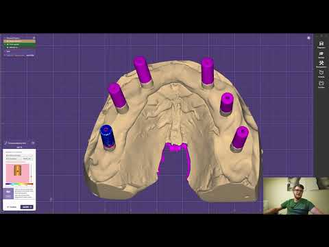 Видео: Как сканировать мультиюниты и как выбирать библиотеки для all in 4?
