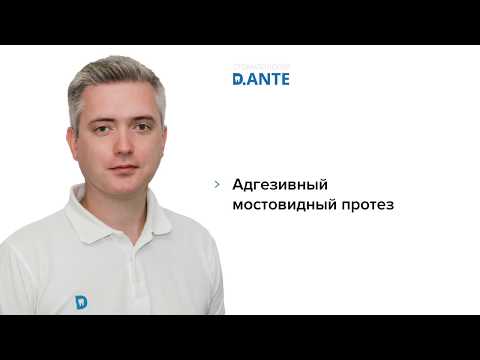 Видео: Установка адгезивного мостовидного протеза в Киеве — стоматология D.Ante (Киев, м. Олимпийская)