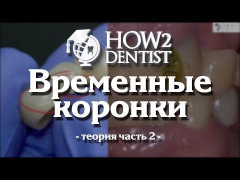 Видео: Как изготовить временные коронки. Часть 2 - теория / How to dentist