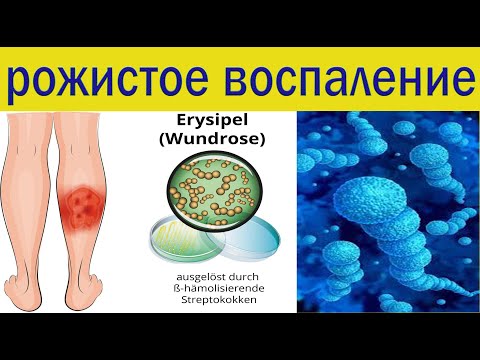 Видео: Как навсегда вылечить рожистое воспаление. Полная схема лечения.