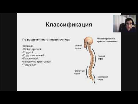 Видео: Сколиоз у детей: клиника диагностика лечение (вебинар)