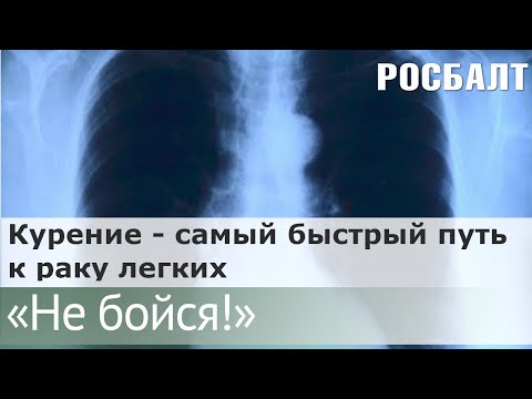 Видео: Подкаст "Не бойся!"  Почему рак легких трудно выявить на ранней стадии