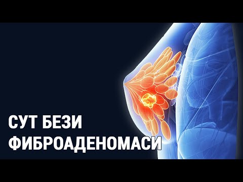 Видео: Сут бези фиброаденомаси