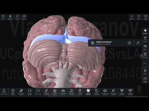 Видео: Оболочки головного мозга на интерактивном атласе "Пирогов"