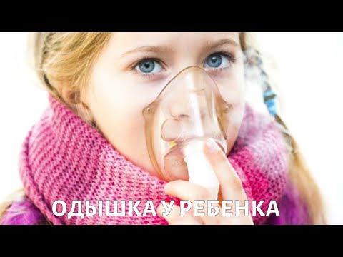 Видео: Сильная ОДЫШКА и кашель у ребенка: памятка для родителей