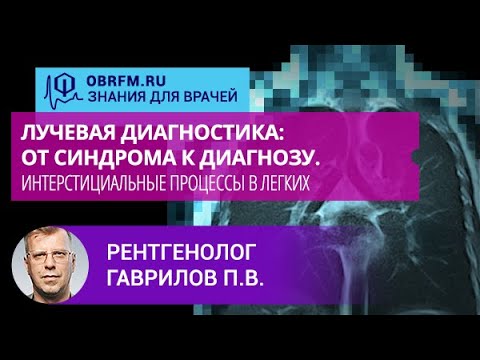 Видео: Рентгенолог Гаврилов П.В.: Лучевая диагностика. Интерстициальные процессы в легких