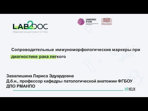 Видео: Сопроводительные иммуноморфологические маркеры при диагностике рака легкого