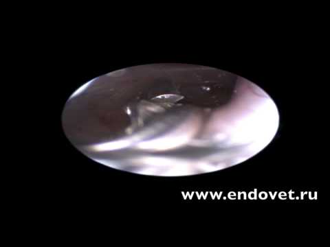 Видео: Инородное тело трахеи