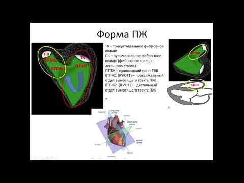 Видео: ОСНОВЫ ЭХОКАРДИОГРАФИИ: Оценка структуры и функции правого  желудочка