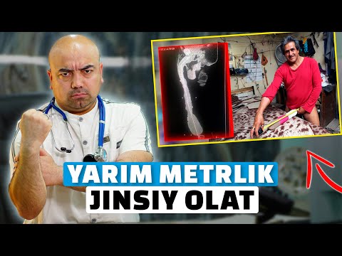 Видео: ЖИНСИЙ ОЛАТНИ КАТТА ҚИЛИШНИНГ ФОЙДАСИ ВА ЗАРАРИ