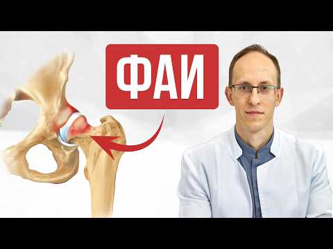 Видео: Боль в тазобедренном суставе из-за фемороацетабулярного импинджмента. Что это? И как лечить?